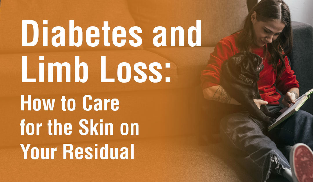 Diabetes and Limb Loss: How to Care for the Skin on Your Residual