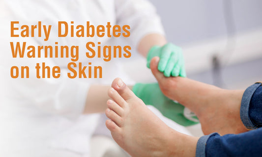 Early Diabetes Warning Signs on the Skin