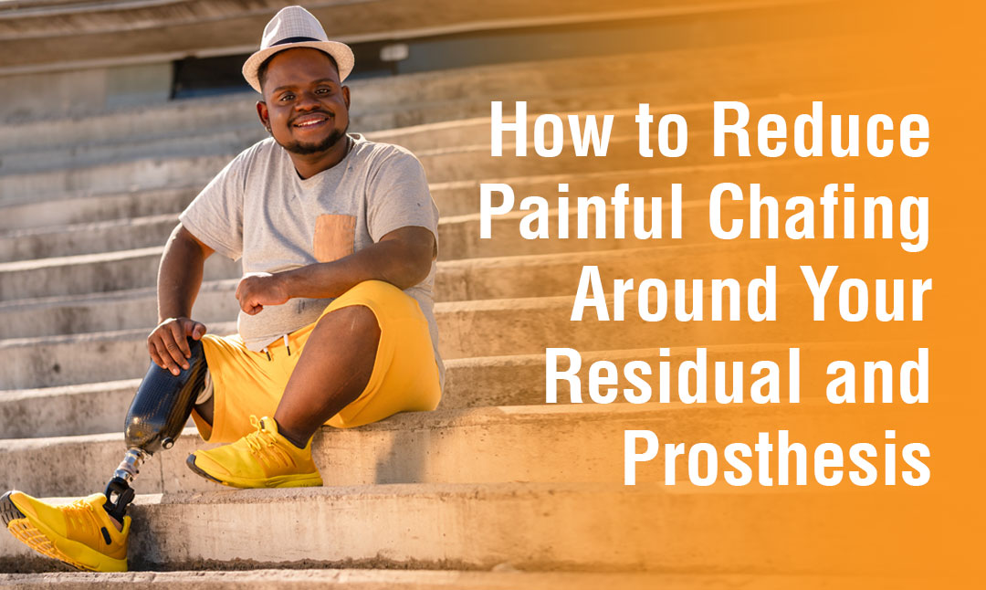 How to Reduce Painful Chafing Around Your Residual and Prosthesis