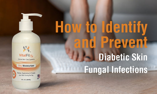 How to Identify and Prevent Diabetic Skin Fungal Infections